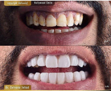 Charger l&#39;image dans la galerie, مبيض الأسنان  +  power floss جهاز